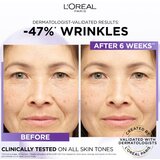 L´Oréal Paris Revitalift Filler HA 1,5% učvrstitvena krema s hialuronsko kislino 30 ml za ženske | Shoptok.si