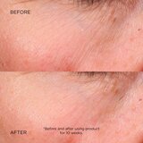Darphin Éclat Sublime Dual Rejuvenating Micro-Serum serum za regeneraciju i pomlađivanje 30 ml | shoptok.hr