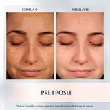 Eucerin Anti-Pigment lokalna korektivna njega protiv pigmentnih mrlja 5 ml | shoptok.hr