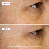 Novexpert The Plumping Cream krema za polnjenje gub za normalno do suho kožo 40 ml | Shoptok.si
