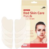 Wooshin Labottach Red Skin Care Patch hidrogel obliži za pomiritev pordele kože za pomiritev kože 2 par | Shoptok.si
