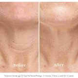 Silkn FaceTite Ritual uređaj za čišćenje lica protiv bora | shoptok.hr