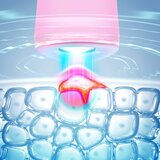 Foreo ESPADA™ 2 pero z modro lučko za pomirjenje pojava aken Pearl Pink 1 kos | Shoptok.si