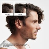 Nioxin System 2 Scalp Therapy darilni set za redke lase 3 kos | Shoptok.si