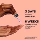 IT Cosmetics Bye Bye Breakout serum za obraz za regulacijo prekomernega sebuma in aken s salicilno kislino za ženske 30 ml | Shoptok.si