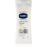 Vaseline intensive care advanced repair vlažilen losjon za telo za suho kožo 400 ml za ženske | Shoptok.si