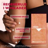 Mixa Urea Cica Repair+ regeneracijska krema za telo za zelo suho kožo 400 ml | Shoptok.si