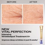 Shiseido Vital Perfection Intensive WrinkleSpot Treatment A+ lokalna nega proti gubam in temnim madežem 20 ml | Shoptok.si