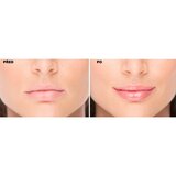 FacEvolution LipPlus Booster nega za povečanje volumna ustnic odtenek Transparent 5 ml | Shoptok.si