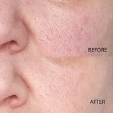 Perricone MD Hypoallergenic Clean Correction Smoothing Restorative Serum gladilni serum za hidracijo in posvetlitev kože 59 ml | Shoptok.si