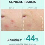 Apivita Just Bee Clear Serum serum za masnu i problematičnu kožu 30 ml | shoptok.hr