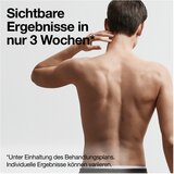 Braun Silk-expert Pro IPL PL5145 dlak | Shoptok.si