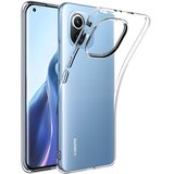  Przezračno zaštitno kućište za Xiaomi Mi 11 - Prozirna KP9362 | shoptok.hr