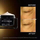 Filorga GLOBAL-REPAIR ADVANCED EYES & LIPS krema proti gubam za konture oči in ustnic 15 ml | Shoptok.si