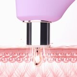 Foreo KIWI™ Derma uređaj za dijamantnu mikrodermoabraziju i čišćenje pora 1 kom | shoptok.hr