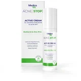 aktivna krema acne stop active lotion