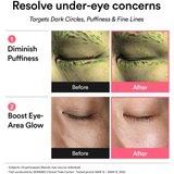 Abib PDRN Retinal Eye Patch Glow Jelly blazinice za pod oči proti gubam, zabuhlosti in temnim kolobarjem 60 kos Slike