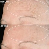 StriVectin Anti-Wrinkle SD Advanced Plus koncentrirana krema za redukcijo gub 118 ml | Shoptok.si