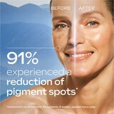  Serum protiv pigmentnih mrlja - 30 ml | shoptok.hr