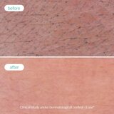 Novexpert Clear Skin pena za umivanje – čišćenje za masnu i problematičnu kožu | Eponuda.com
