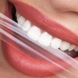 HELLO SMILE trakice za izbeljivanje zuba | Eponuda.com