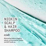 Nioxin System 3 Scalp + Hair Shampoo čistilni šampon za barvane redke lase 1000 ml | Shoptok.si