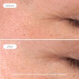 Novexpert Pro-Collagen Booster Serum – Serum za Podsticanje Kolagena | Eponuda.com
