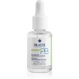 Acnestil PB pomirjajoči gel za mastno in problematično kožo 30 ml