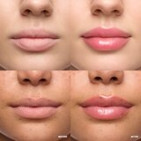 WONDERSKIN Lip Relapse Plumping Gloss sijaj za ustnice z učinkom povečanja odtenek Clear 3.57 ml | Shoptok.si