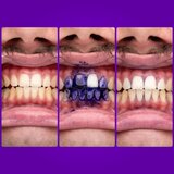 LYSS V34 korektor za beljenje 30 ml | Shoptok.si