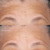 Perricone MD Hypoallergenic Clean Correction vlažilna in hranilna krema 59 ml | Shoptok.si