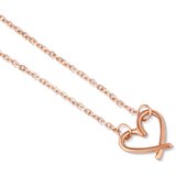 Vuch Emery Rose Gold Bracelet | ePonuda.com