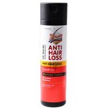  Šampon protiv opadanja kose Dr.Sante Anti Hair Loss – 250 ml | Eponuda.ba