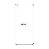 Xiaomi MI 11 HYDROGEL ZAŠTITNA FOLIJA Cijene