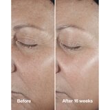 Clinique Smart Clinical™ Repair Wrinke Correcting Serum serum za obraz za korekcijo gub 75 ml | Shoptok.si