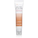 Himalaya Herbals Acne Clear+ Treatment Pen lokalna njega protiv akni 15 ml | shoptok.hr