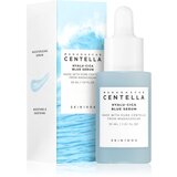SKIN1004 Madagascar Centella Hyalu-Cica Blue Serum intenzivni hidratantni serum za smirenje i jačanje osjetljive kože lica 30 ml | shoptok.hr