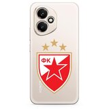  Futrola ultra tanki print clear za honor 400 zf004 ( F124451 ) | Eponuda.com