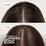Goldwell Dualsenses Scalp Specialist Clarifying Shampoo šampon za dubinsko čišćenje 250 ml | shoptok.hr