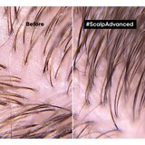 L´Oréal Paris Scalp Advanced Anti-Oiliness Professional Clay glina za globinsko čiščenje las 250 ml za ženske | Shoptok.si