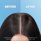 Head & Shoulders Citrus Fresh šampon proti prhljaju 540 ml | Shoptok.si