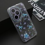  Futrola whisper za honor 400 pro plava ( F123951 ) | Eponuda.com