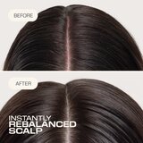 Goldwell Dualsenses Scalp Specialist Rebalance & Hydrate Fluid hidratantni fluid za obnovljanje vlasišta 150 ml | shoptok.hr