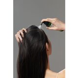 SOMEBYMI Cica Peptide Anti Hair Loss Derma Scalp Tonic hidratantni i hranjivi tonik protiv gubitka kose 150 ml | shoptok.hr