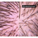 L´Oréal Paris Serie Expert Scalp Advanced šampon za občutljivo in razdraženo lasišče 300 ml | Shoptok.si