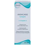Synchroline Aknicare krema protiv akni kod seboroičnog dermatitisa 50 ml | shoptok.hr