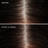 Moroccanoil Scalp Conditioner pomirjevalni balzam za mastno lasišče proti prhljaju 70 ml | Shoptok.si