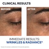 Uriage Age Absolu Blur-redensifying Eye Balm anti-age krema za područje oko očiju 15 ml | shoptok.hr