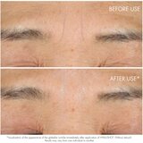Dior Capture Totale Hyalushot korektor za gube s hialuronsko kislino 15 ml | Shoptok.si