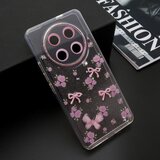  Futrola whisper za honor x9c/magic 7 lite roze ( F123957 ) | Eponuda.com